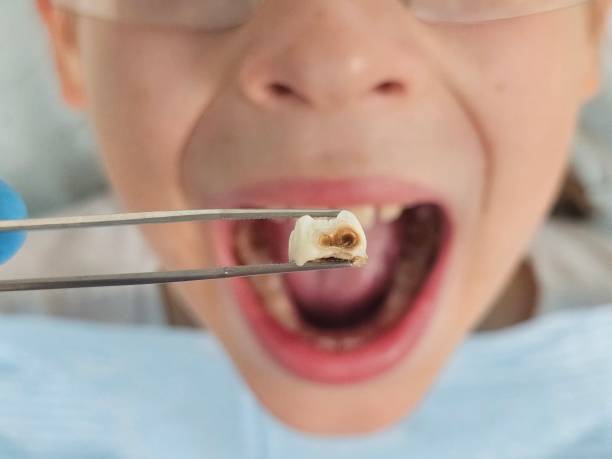 Best Emergency Treatment for Toothache in Fayette, MO
